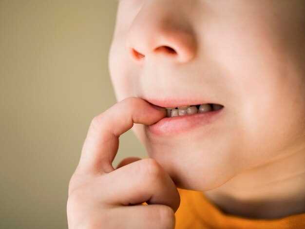 Симптомы молочницы во рту у детей