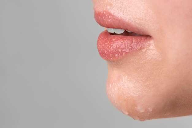 Роль иммунной системы в процессе заживления герпеса на губах