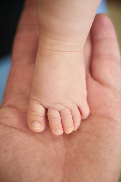 Как распознать грибок на ногтях ребенка на ранней стадии